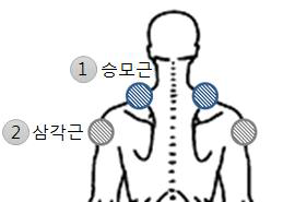 통각 측정 부위 : 승모근, 삼각근