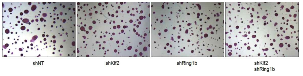AP staining을 통한 Klf2 전사인자와 Ring1b의 줄기세포능 변화 분석