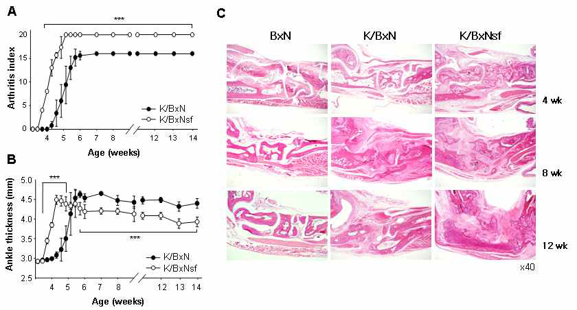 Clinical and histopathological evaluation of K/BxNsf pathology