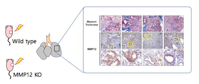 MMP12 발현 유무에 따른 정밀방사선조사 후 폐섬유화 패턴 비교