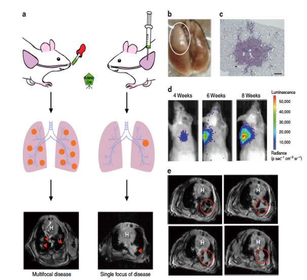 유전자 변형 마우스를 이용한 자발적 폐암동물모델에서 Image-guided radiotherapy를 이용한 폐암반응성 연구결과