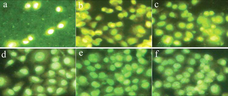 PC-12 세포들의 형광이미지 비교. 각각 실리콘 표면 (a, d), polydopamine 표면(b, e) BSA 고정화된 표면(c, f) 위에서의 세포 접착 능력을 대변함. 배양시간 12 h(a, b, c) 과 48 h(d, e, f).