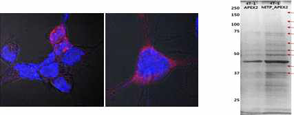 3T3-L1 지방세포에 APEX-endotrophin 의 발현을 confocal microscpy image 로 확인함.
