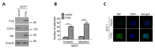 FYN 과발현에 의한 내강형 유방암세포의 중배엽성 세포 형질 획득
