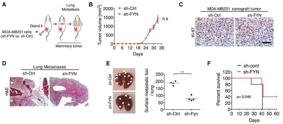 FYN Kinase 발현 감소에 의한 기저형 유방암세포의 in vivo 암전이능 억제 효과