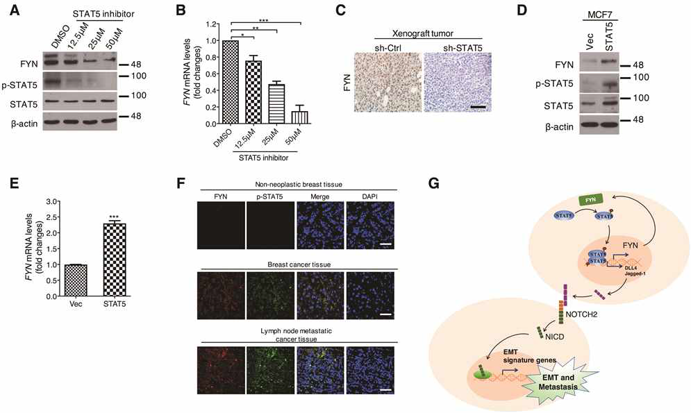 STAT5-FYN 양성피드백 루프에 의한 기저형 유방암세포의 전이능 획득 기전