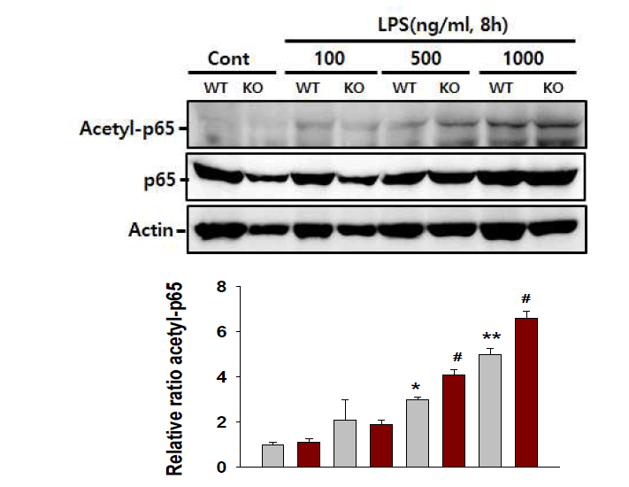 Immunoblot analyses of Acetyl-p65 and p65. Bone marrow-derived macrophage from SIRT2 knockout or wild type mouse were stimulated with ATP (1 and 5 mM) for 30 minutes and culture media was harvested 8 h after LPS treatment.