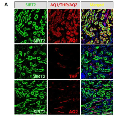 Triple immunofluorescence staining of SIRT2, aquaporin (AQ) 1, Tamm–Horsfall glycoprotein (THP) and AQ2 in the Western blot analysis of SIRT2 in the kidney of Sirt2+/+and Sirt2-/- mice.