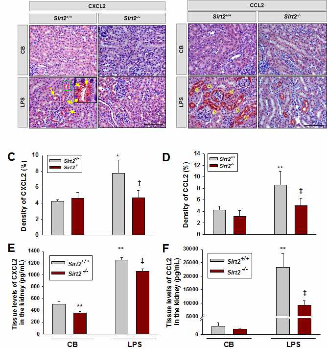 Localization of immunoreactive CXCL2 and CCL2 in renal tissue of Sirt2+/+and Sirt2-/-mice after injection with LPS.