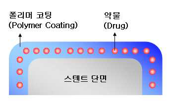 스텐트 단면