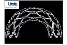 Cordis 사의 Cypher Stent