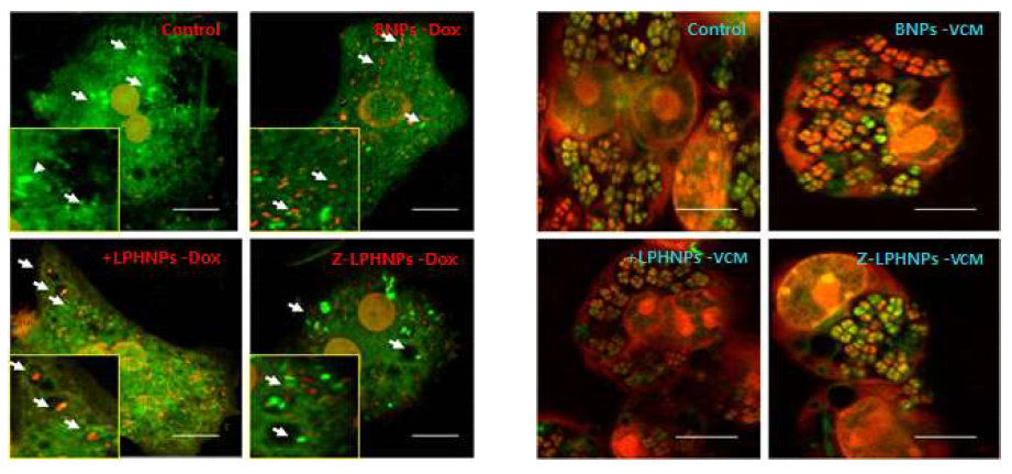 Intracellular bactericidal action of LPHNPs-DOX/VCM in M.seg infected J774.1 or S.aereus infected RAW cells