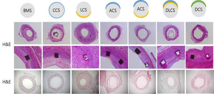 다양한 코팅의 조직 병리학적 검사 결과(사진)