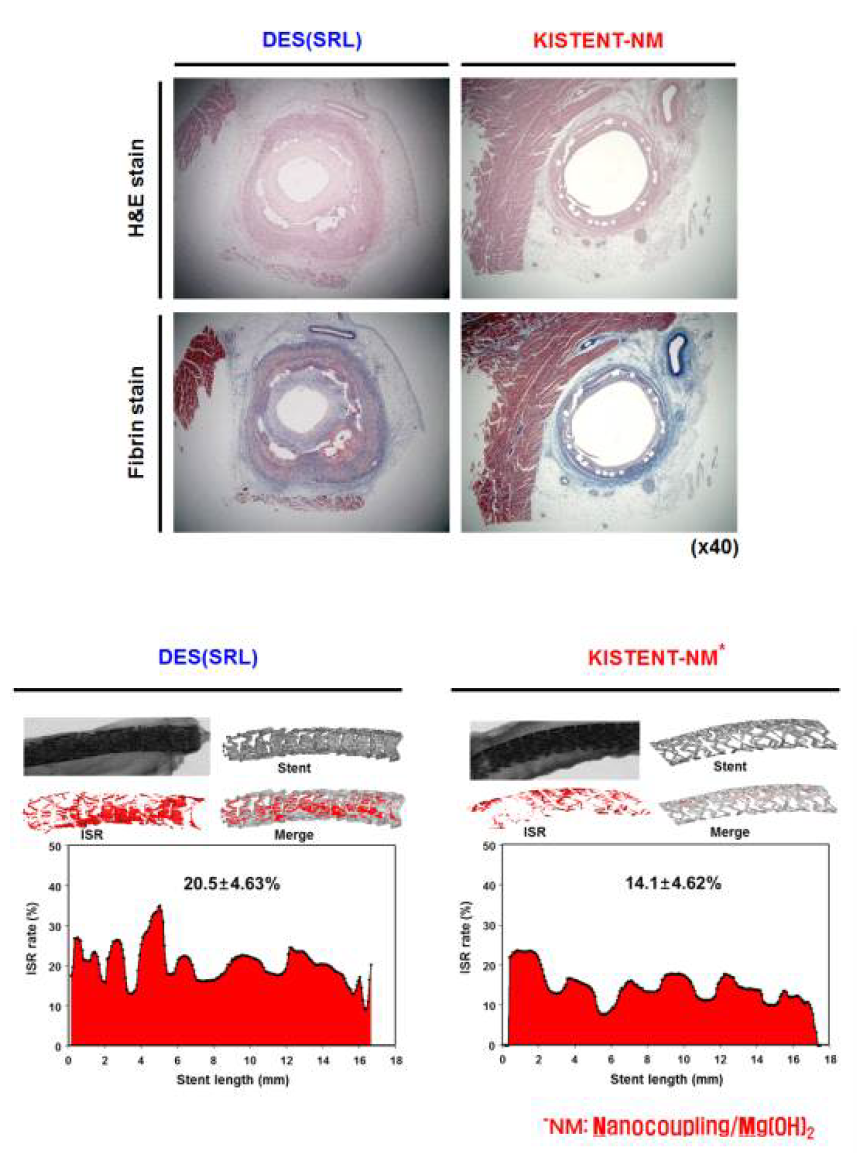 In vivo coronary implants of DES/RA-Mg-OLA