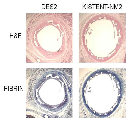 조직 분석 H&E, Fibrin 염색