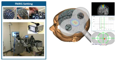 기능적 근적외선분광기를 활용한 실시간 모니터링 및 비침습 뇌자극 자극 위치 제어
