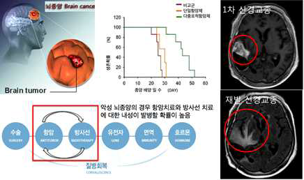 악성뇌종양 환자의 치료 및 생존율.