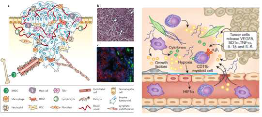 종양 주변 조직의 미세환경.