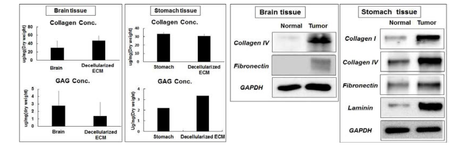 Chemical assay 및 western blot을 이용한 환자 채취 종양 내 ECM 구성 성분 분석