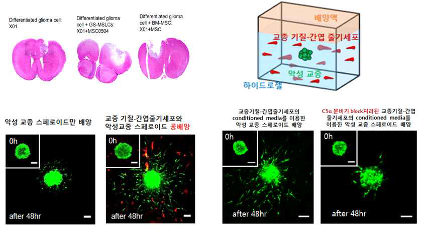 환자 종양 유래 기질세포의 종양 스페로이드 악성화 확인