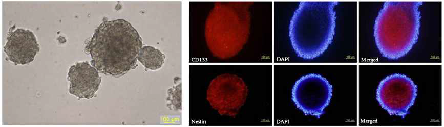 자발적 증식되어 형성된 환자 유래 암줄기세포 organoid