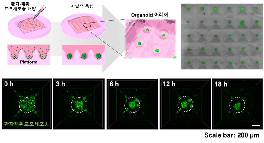 Microwell 기반 organoid 어레이 플랫폼에서의 암줄기세포의 organoid 형성