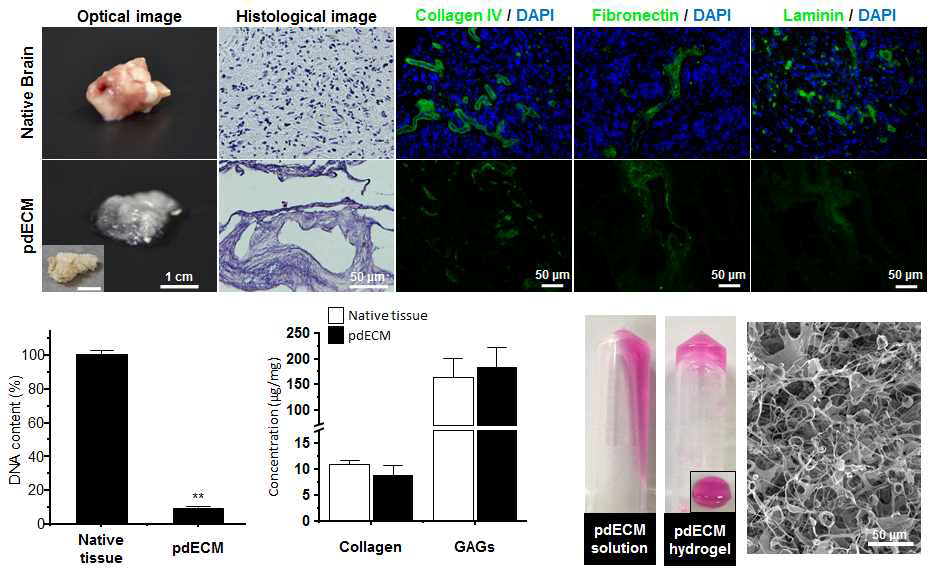 탈세포화 (decellularization) 과정 이후 포집된 교모세포종 ECM의 분류 및 분석