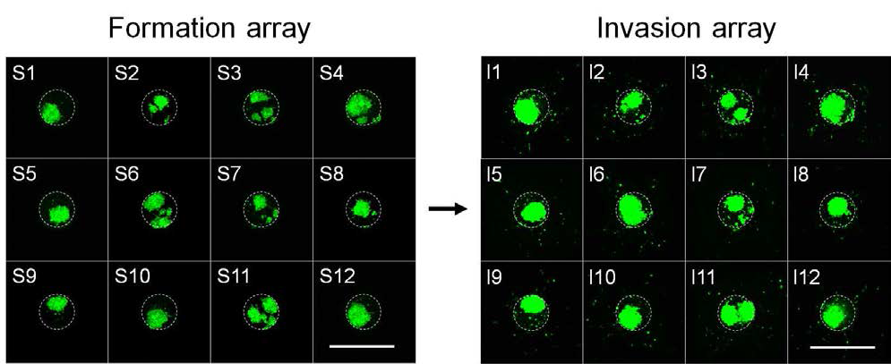 종양미세환경어레이 플랫폼을 활용한 종양 형성 능력 및 침윤 특성 확인을 위한 어레이 스크리닝
