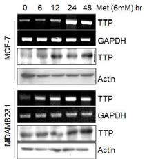 Metformin induces TTP expression in both p53 wild-type and p53 mutant cancer cells.