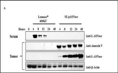 L-Asparaginase 의 고형 종양 형성 억제 메카니즘 연구.