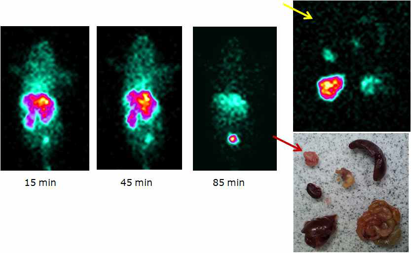 Tc-99m BBN-cello 2.5X-ED-TP-Au@NP를 꼬리정맥으로 주사한 결과임.