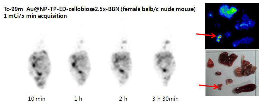 Tc-99m BBN-cello 2.5X-ED-TP-Au@NP를 복강으로 주사한 결과임.