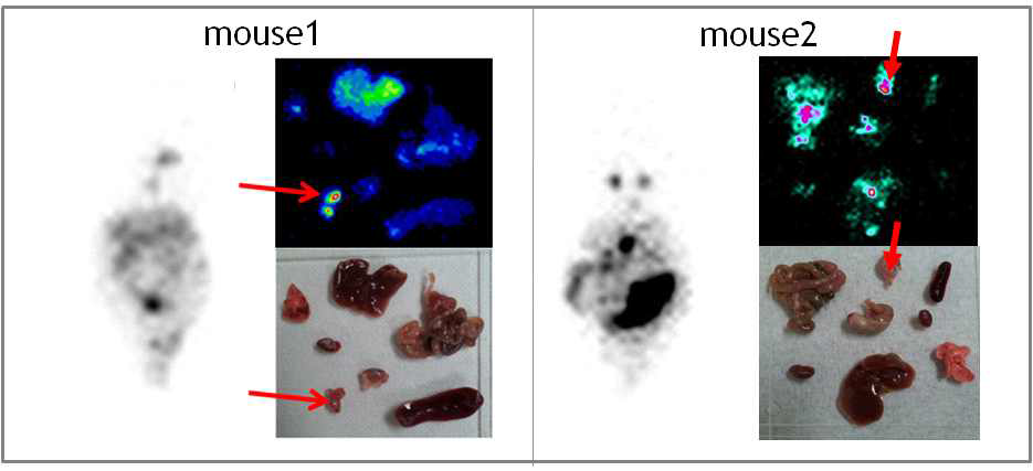 Gamma camera images of Tc-99m labeled BBN-cellobiose(2.5X)-ED-TP-Au@NP