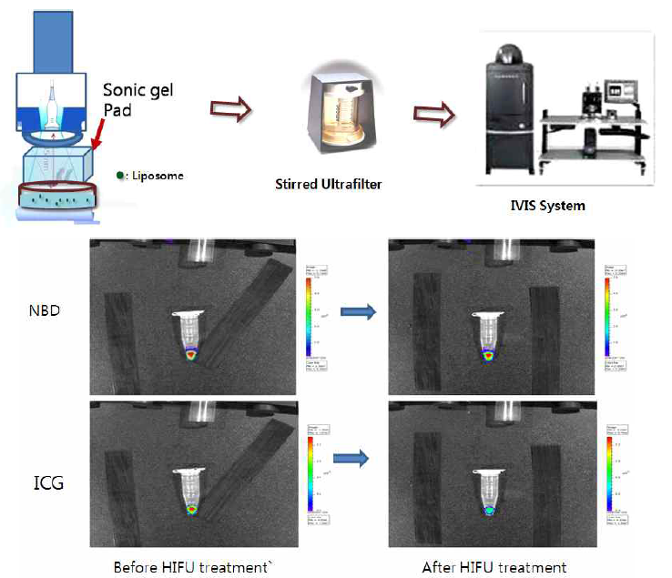 HIFU 처리 전․후의 광학영상
