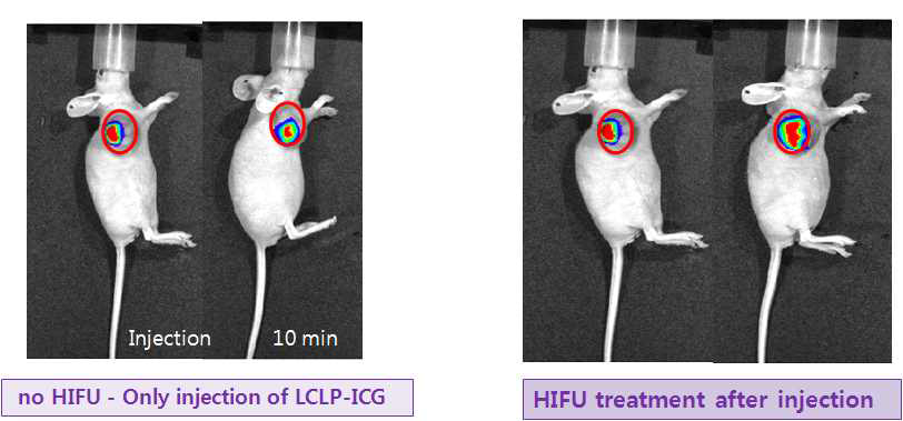 CT26 종양모델을 가진 마우스에 intratumal 방법으로 LCLP-ICG(1mM) 주입하고 HIFU 처리 유무에 따른 초기 10분에서 광학영상 비교