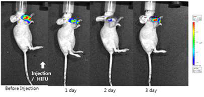CT26 종양모델을 가진 마우스에 I.v. 방법으로 LCLP-Dox 주입하고 HIFU 처리한 마우스의 시간에 따른 광학영상