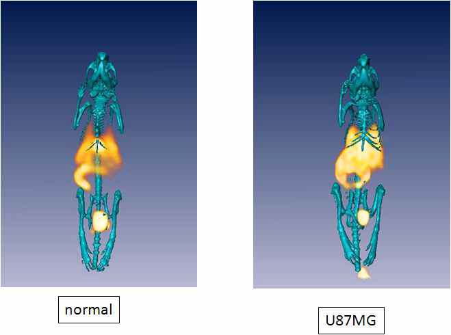 F-18 Cy5.5-RGD-SPION 주입 후 120분 후에 얻은 PET-CT image