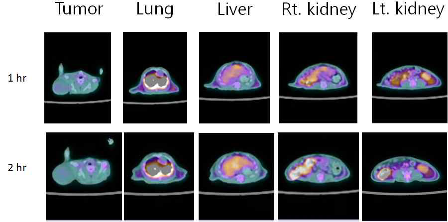 F-18 RGD-SPDP-SPION을 종양마우스에 주사후 PET-CT 영상