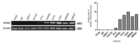 SPARC mRNA 발현조사