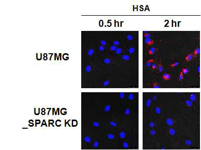 U87MG와 U87MG_SPARC KD에서 in vitro 알부민 uptake 차이 비교