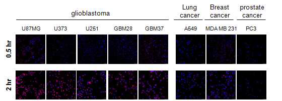 confocal imaging을 통한 여러 암세포주에서 in vitro 알부민 uptake 비교