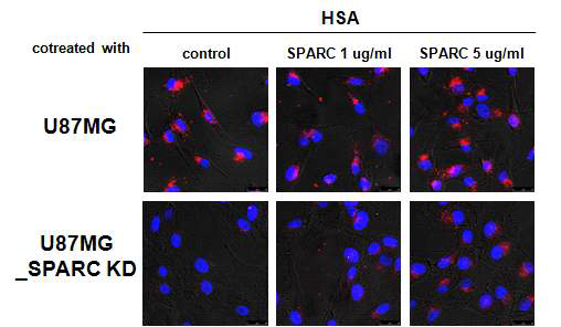 exogenous SPARC 농도별 처리에 따른 in vitro 알부민 uptake 변화 비교