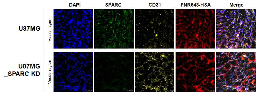 confocal imaging을 통한 종양조직 내 SPARC과 알부민 distribution 비교