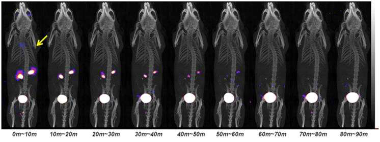 경쟁반응 기준물질 투여 후 SNUBH-NM-505의 SPECT/CT 영상