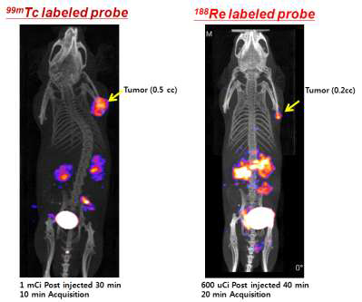 Tc-99m과 Re-188 표지화합물의 SPECT/CT 영상