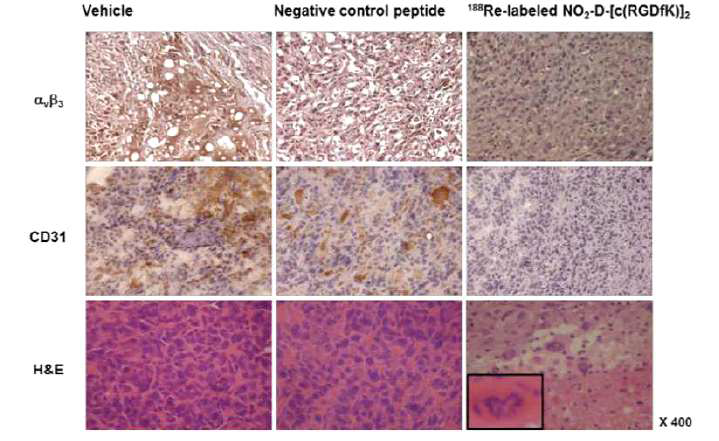 Immunohistochemical staining with anti-αvβ3, anti-CD-31 and H&E in tumor sections