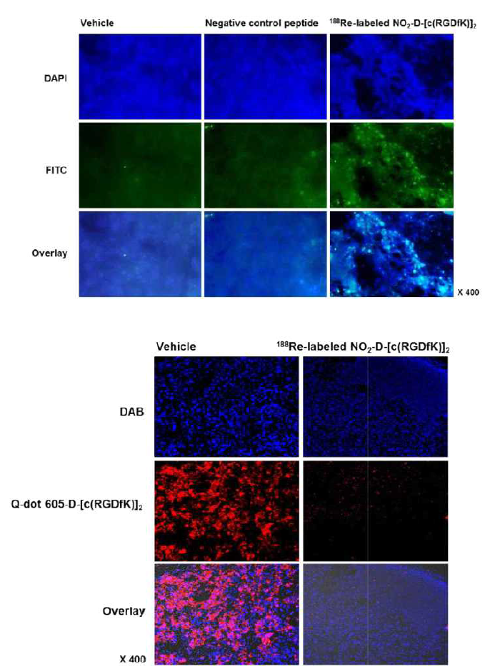 Immunofluorescence imaging with γH2AX for DNA damage and Q-dot 605-cRGD for αvβ3 receptors in tumor sections