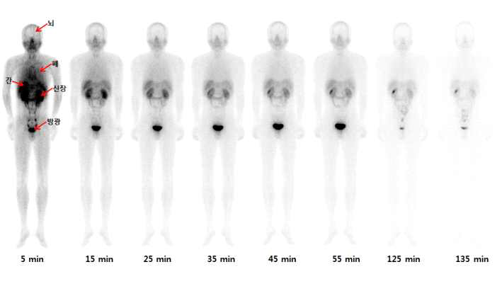 SNUBH-NM-505 정상인에서의 전신 SPECT 영상