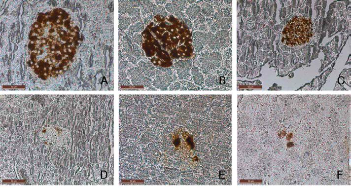 Change in insulin iummunoreactivity in β cells of pancreatic islets in association with soybean feeding and streptozotocin after 6 weeks.