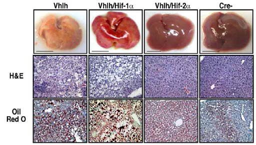 Differential role of HIF-1α and HIF-2α for hepatic steatosis
